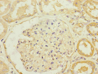 SLC13A2 / NaCT Antibody - Immunohistochemistry of paraffin-embedded human kidney tissue at dilution 1:100