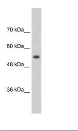SLC13A3 Antibody - Jurkat Cell Lysate.  This image was taken for the unconjugated form of this product. Other forms have not been tested.