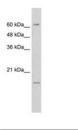 SLC13A3 Antibody - HepG2 Cell Lysate.  This image was taken for the unconjugated form of this product. Other forms have not been tested.