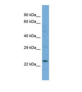 SLC13A3 Antibody - Western blot of Human COLO205. SLC13A3 antibody dilution 1.0 ug/ml.  This image was taken for the unconjugated form of this product. Other forms have not been tested.
