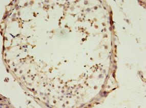 SLC13A4 Antibody - Immunohistochemistry of paraffin-embedded human testis using antibody at 1:100 dilution.  This image was taken for the unconjugated form of this product. Other forms have not been tested.
