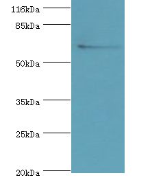 SLC13A4 Antibody - Western blot. All lanes: SLC13A4 antibody at 2 ug/ml+293T whole cell lysate. Secondary antibody: Goat polyclonal to rabbit at 1:10000 dilution. Predicted band size: 69 kDa. Observed band size: 69 kDa.  This image was taken for the unconjugated form of this product. Other forms have not been tested.