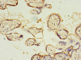 SLC13A4 Antibody - Immunohistochemistry of paraffin-embedded human placenta tissue using SLC13A4 Antibody at dilution of 1:100