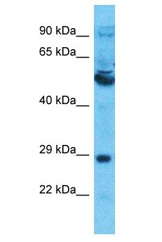 SLC13A5 Antibody - SLC13A5 antibody Western Blot of Thymus Tumor. Antibody dilution: 1 ug/ml.  This image was taken for the unconjugated form of this product. Other forms have not been tested.