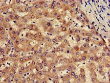 SLC13A5 Antibody - Immunohistochemistry of paraffin-embedded human liver tissue using SLC13A5 Antibody at dilution of 1:100