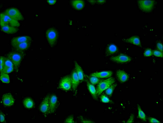 SLC13A5 Antibody - Immunofluorescent analysis of HepG2 cells using SLC13A5 Antibody at a dilution of 1:100 and Alexa Fluor 488-congugated AffiniPure Goat Anti-Rabbit IgG(H+L)