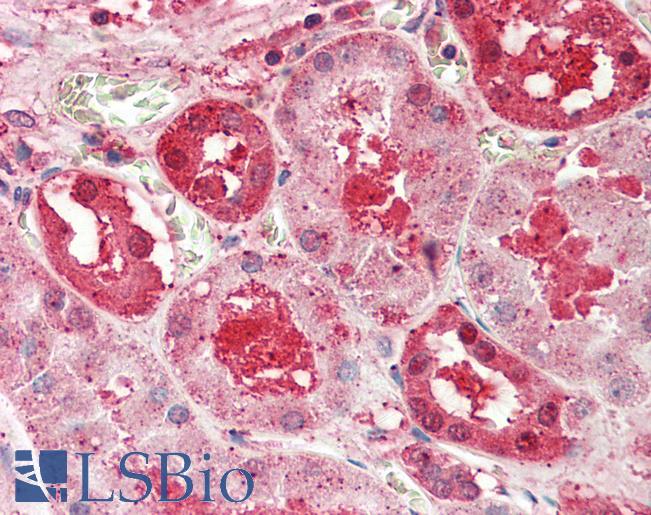 SLC14A1 / JK Antibody - Anti-SLC14A1 / JK antibody IHC staining of human kidney. Immunohistochemistry of formalin-fixed, paraffin-embedded tissue after heat-induced antigen retrieval. Antibody concentration 5 ug/ml.  This image was taken for the unconjugated form of this product. Other forms have not been tested.