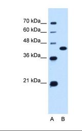 SLC14A1 / JK Antibody - Lane A: Marker. Lane B: Jurkat cell lysate. Antibody concentration: 0.25 ug/ml. Gel concentration: 12%.  This image was taken for the unconjugated form of this product. Other forms have not been tested.