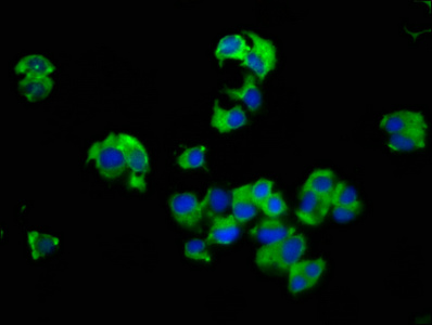 SLC14A1 / JK Antibody - Immunofluorescence staining of MCF-7 cells at a dilution of 1:66, counter-stained with DAPI. The cells were fixed in 4% formaldehyde, permeabilized using 0.2% Triton X-100 and blocked in 10% normal Goat Serum. The cells were then incubated with the antibody overnight at 4 °C.The secondary antibody was Alexa Fluor 488-congugated AffiniPure Goat Anti-Rabbit IgG (H+L) .