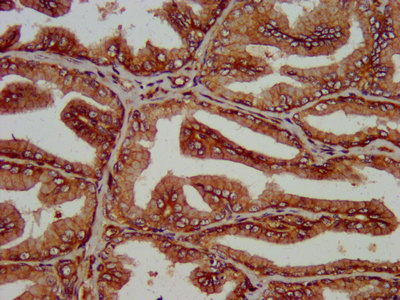 SLC14A1 / JK Antibody - Immunohistochemistry image at a dilution of 1:200 and staining in paraffin-embedded human prostate tissue performed on a Leica BondTM system. After dewaxing and hydration, antigen retrieval was mediated by high pressure in a citrate buffer (pH 6.0) . Section was blocked with 10% normal goat serum 30min at RT. Then primary antibody (1% BSA) was incubated at 4 °C overnight. The primary is detected by a biotinylated secondary antibody and visualized using an HRP conjugated SP system.