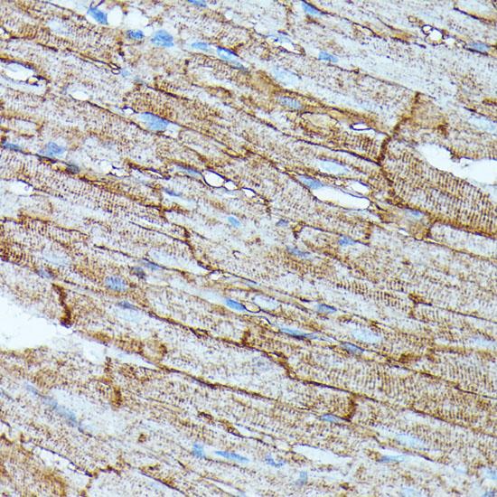 SLC14A1 / JK Antibody - Immunohistochemistry of paraffin-embedded Rat heart using SLC14A1 Polyclonal Antibody at dilution of 1:100 (40x lens).