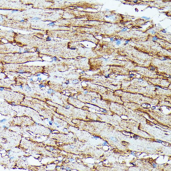 SLC14A1 / JK Antibody - Immunohistochemistry of paraffin-embedded Mouse heart using SLC14A1 Polyclonal Antibody at dilution of 1:100 (40x lens).