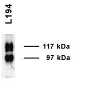 SLC14A2 / UTR Antibody - Western blot analysis of UT-A1 in rat inner medulla using a 1:1000 dilution of SLC14A2 / UTR antibody.  This image was taken for the unconjugated form of this product. Other forms have not been tested.