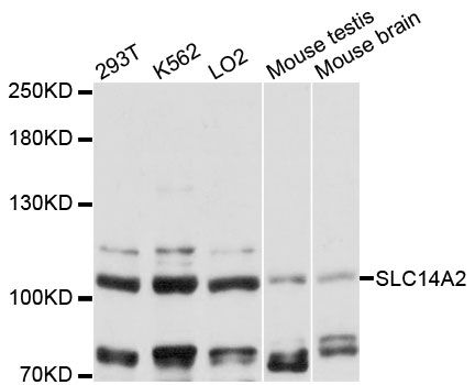 SLC14A2 / UTR Antibody - Western blot analysis of extracts of various cell lines, using SLC14A2 antibody at 1:3000 dilution. The secondary antibody used was an HRP Goat Anti-Rabbit IgG (H+L) at 1:10000 dilution. Lysates were loaded 25ug per lane and 3% nonfat dry milk in TBST was used for blocking. An ECL Kit was used for detection and the exposure time was 60s.