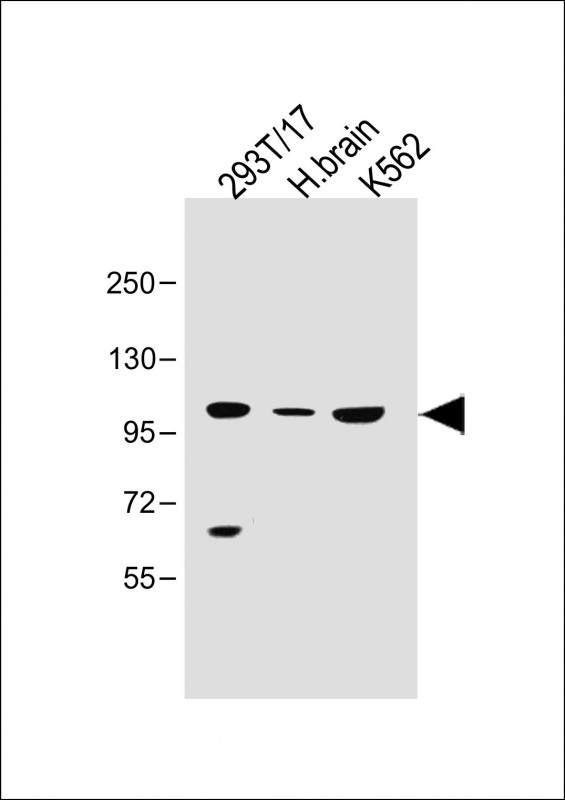 SLC14A2 / UTR Antibody - All lanes: Anti-SLC14A2 Antibody (N-Term) at 1:500 dilution Lane 1: 293T/17 whole cell lysate Lane 2: Human brain lysate Lane 3: K562 whole cell lysate 293T/17 whole cell lysate at 30 µg per lane. H. brain lysate at 50 µg per lane. K562 whole cell lysate at 40 µg per lane. Secondary Goat Anti-Rabbit IgG, (H+L), Peroxidase conjugated at 1/10000 dilution. Predicted band size: 101 kDa Blocking/Dilution buffer: 5% NFDM/TBST.