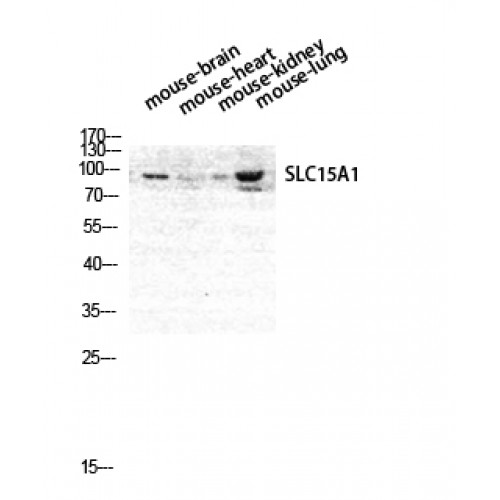 SLC15A1 / PEPT1 Antibody - Western blot of PEPT1 antibody