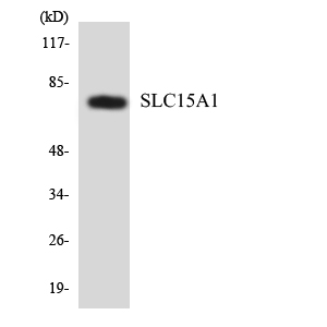 SLC15A1 / PEPT1 Antibody - Western blot analysis of the lysates from HeLa cells using SLC15A1 antibody.