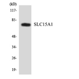 SLC15A1 / PEPT1 Antibody - Western blot analysis of the lysates from HeLa cells using SLC15A1 antibody.