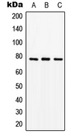 SLC15A1 / PEPT1 Antibody - Western blot analysis of PEPT1 expression in Jurkat (A); SP2/0 (B); PC12 (C) whole cell lysates.