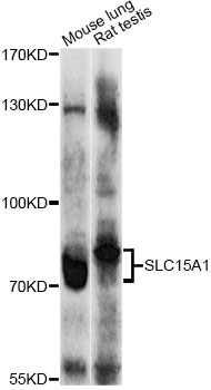 SLC15A1 / PEPT1 Antibody - Western blot analysis of extracts of various cell lines, using SLC15A1 antibody at 1:1000 dilution. The secondary antibody used was an HRP Goat Anti-Rabbit IgG (H+L) at 1:10000 dilution. Lysates were loaded 25ug per lane and 3% nonfat dry milk in TBST was used for blocking. An ECL Kit was used for detection and the exposure time was 90s.