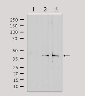 SLC15A1 / PEPT1 Antibody - Western blot analysis of extracts of various samples using SLC15A1 antibody. Lane 1: HeLa treated with blocking peptide; Lane 2: HeLa; Lane 3: mouse kidney;