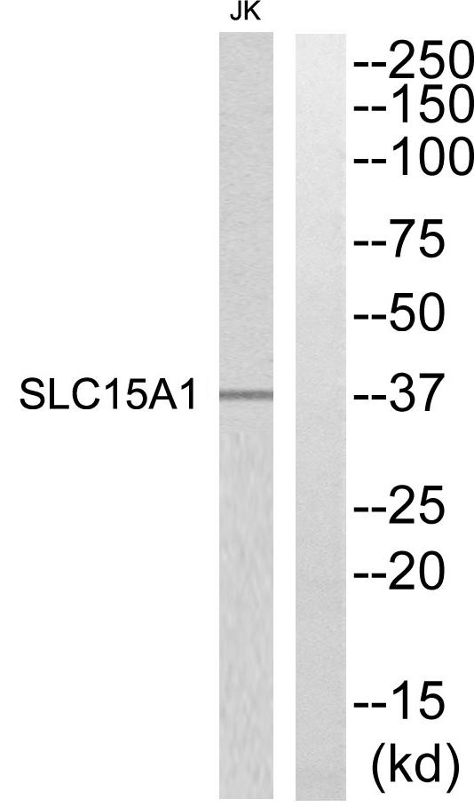 SLC15A1 / PEPT1 Antibody - Western blot analysis of extracts from Jurkat cells, using SLC15A1 antibody.