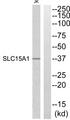 SLC15A1 / PEPT1 Antibody - Western blot analysis of extracts from Jurkat cells, using SLC15A1 antibody.