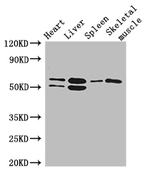 SLC15A3 Antibody - Positive WB detected in:Mouse heart tissue,Mouse liver tissue,Mouse spleen tissue,Mouse skeletal muscle tissue;All lanes:SLC15A3 antibody at 5ug/ml;Secondary;Goat polyclonal to rabbit IgG at 1/50000 dilution;Predicted band size: 64 kDa;Observed band size: 64,50 kDa;