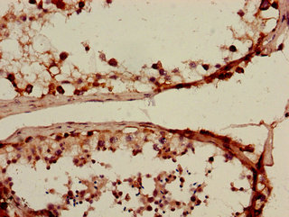 SLC15A3 Antibody - Immunohistochemistry of paraffin-embedded human testis tissue using SLC15A3 Antibody at dilution of 1:100