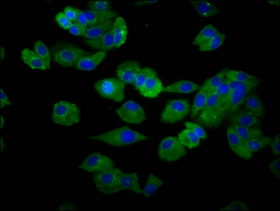SLC15A4 / PHT1 Antibody - Immunofluorescence staining of HepG2 cells diluted at 1:66, counter-stained with DAPI. The cells were fixed in 4% formaldehyde, permeabilized using 0.2% Triton X-100 and blocked in 10% normal Goat Serum. The cells were then incubated with the antibody overnight at 4°C.The Secondary antibody was Alexa Fluor 488-congugated AffiniPure Goat Anti-Rabbit IgG (H+L).