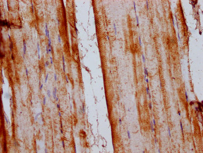 SLC15A4 / PHT1 Antibody - Immunohistochemistry Dilution at 1:200 and staining in paraffin-embedded human skeletal muscle tissue performed on a Leica BondTM system. After dewaxing and hydration, antigen retrieval was mediated by high pressure in a citrate buffer (pH 6.0). Section was blocked with 10% normal Goat serum 30min at RT. Then primary antibody (1% BSA) was incubated at 4°C overnight. The primary is detected by a biotinylated Secondary antibody and visualized using an HRP conjugated SP system.