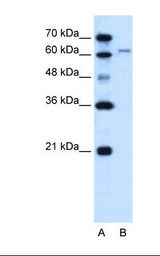 SLC15A4 / PHT1 Antibody - Lane A: Marker. Lane B: HepG2 cell lysate. Antibody concentration: 0.25 ug/ml. Gel concentration: 12%.  This image was taken for the unconjugated form of this product. Other forms have not been tested.