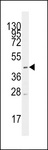 SLC16A1 / MCT1 Antibody - Western blot of anti-SLC16A1 Antibody in CEM cell line lysates (35 ug/lane). SLC16A1 (arrow) was detected using the purified antibody.