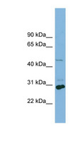 SLC16A1 / MCT1 Antibody - SLC16A1 antibody western blot of HT1080 cell lysate.  This image was taken for the unconjugated form of this product. Other forms have not been tested.