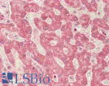 SLC16A1 / MCT1 Antibody - Human Liver: Formalin-Fixed, Paraffin-Embedded (FFPE)