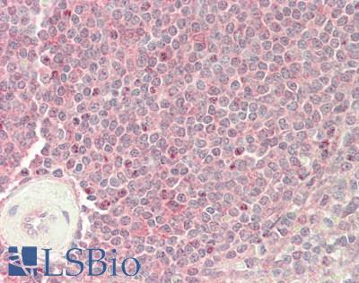 SLC16A1 / MCT1 Antibody - Human Spleen: Formalin-Fixed, Paraffin-Embedded (FFPE)