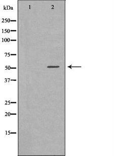 SLC16A1 / MCT1 Antibody - Western blot analysis of extracts of mouse seminoma tissue lysate using SLC16A1 antibody. The lane on the left is treated with the antigen-specific peptide.