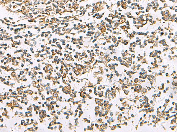 SLC16A1 / MCT1 Antibody - Immunohistochemistry of paraffin-embedded Human tonsil tissue  using SLC16A1 Polyclonal Antibody at dilution of 1:30(×200)