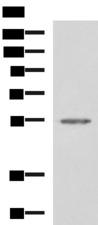 SLC16A1 / MCT1 Antibody - Western blot analysis of Jurkat cell lysate  using SLC16A1 Polyclonal Antibody at dilution of 1:550