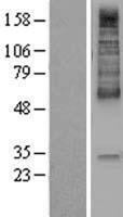 SLC16A1 / MCT1 Protein - Western validation with an anti-DDK antibody * L: Control HEK293 lysate R: Over-expression lysate