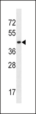 SLC16A10 Antibody - SLC16A10 Antibody western blot of K562 cell line lysates (35 ug/lane). The SLC16A10 antibody detected the SLC16A10 protein (arrow).