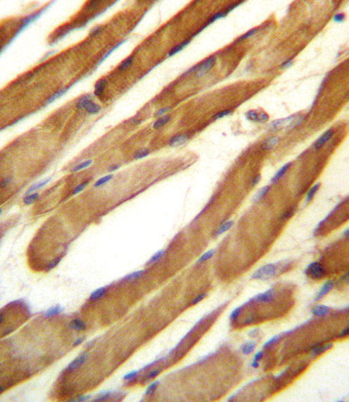 SLC16A10 Antibody - SLC16A10 Antibody immunohistochemistry of formalin-fixed and paraffin-embedded human skeletal muscle followed by peroxidase-conjugated secondary antibody and DAB staining.