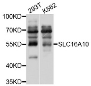 SLC16A10 Antibody - Western blot analysis of extracts of various cell lines, using SLC16A10 antibody at 1:1000 dilution. The secondary antibody used was an HRP Goat Anti-Rabbit IgG (H+L) at 1:10000 dilution. Lysates were loaded 25ug per lane and 3% nonfat dry milk in TBST was used for blocking. An ECL Kit was used for detection and the exposure time was 10s.