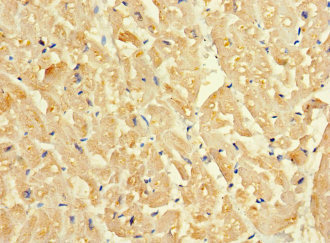 SLC16A10 Antibody - Immunohistochemistry of paraffin-embedded human heart tissue at dilution 1:100
