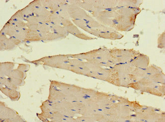 SLC16A10 Antibody - Paraffin-embedding Immunohistochemistry using human skeletal muscle tissue at dilution 1:100
