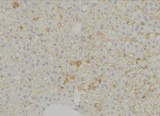 SLC16A11 Antibody - 1:100 staining mouse liver tissue by IHC-P. The sample was formaldehyde fixed and a heat mediated antigen retrieval step in citrate buffer was performed. The sample was then blocked and incubated with the antibody for 1.5 hours at 22°C. An HRP conjugated goat anti-rabbit antibody was used as the secondary.