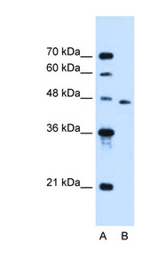 SLC16A12 / MCT12 Antibody - SLC16A12 antibody ARP44186_P050-NP_998771-SLC16A12(solute carrier family 16, member 12 (monocarboxylic acid transporter 12)) Antibody Western blot of Jurkat lysate.  This image was taken for the unconjugated form of this product. Other forms have not been tested.