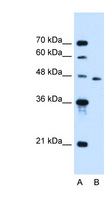 SLC16A12 / MCT12 Antibody - SLC16A12 antibody ARP44186_P050-NP_998771-SLC16A12(solute carrier family 16, member 12 (monocarboxylic acid transporter 12)) Antibody Western blot of Jurkat lysate.  This image was taken for the unconjugated form of this product. Other forms have not been tested.