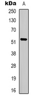 SLC16A12 / MCT12 Antibody - Western blot analysis of MCT12 expression in Jurkat (A) whole cell lysates.