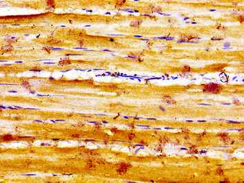 SLC16A12 / MCT12 Antibody - Immunohistochemistry image of paraffin-embedded human skeletal muscle tissue at a dilution of 1:100